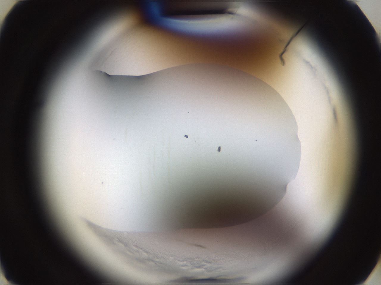 folderID591_plateID2591_batchID13174_wellNum3_profileID1_d3_r202193_ef.jpg
