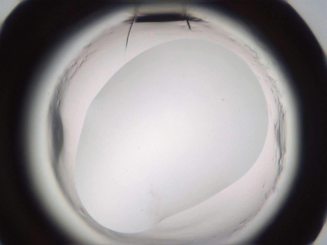 folderID591_plateID2591_batchID13174_wellNum84_profileID1_d3_r202436_ef.jpg