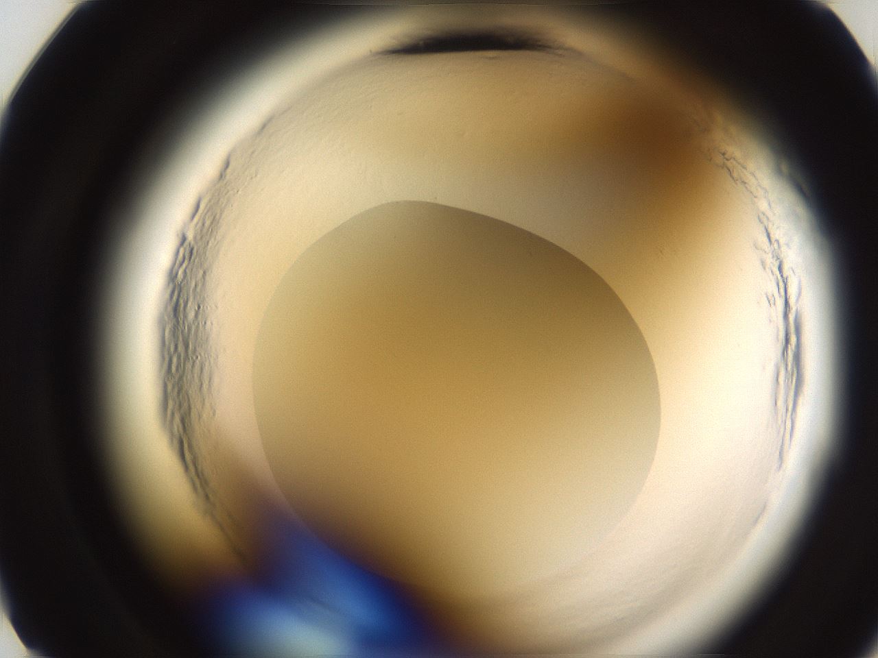 folderID592_plateID2592_batchID13178_wellNum11_profileID1_d2_r203081_ef.jpg