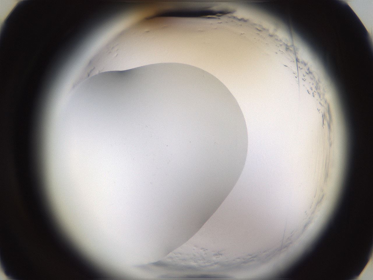 folderID592_plateID2592_batchID13178_wellNum15_profileID1_d3_r203094_ef.jpg