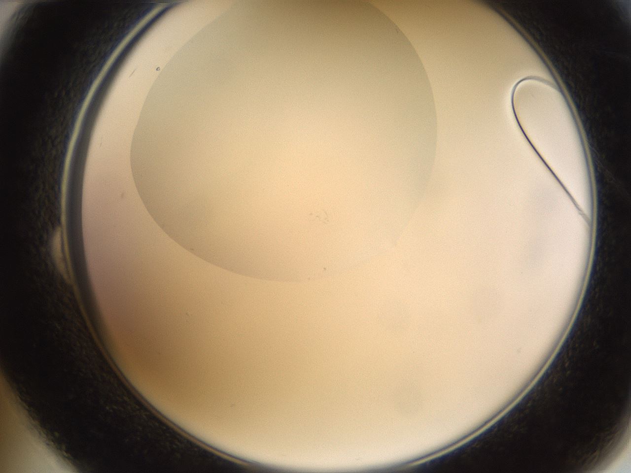 folderID593_plateID1593_batchID6726_wellNum24_profileID1_d2_r105635_ef.jpg