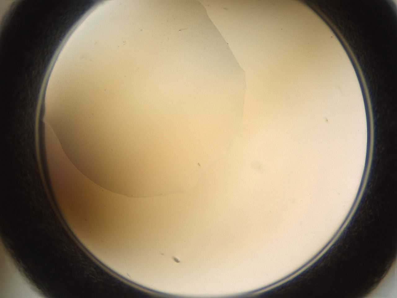 folderID593_plateID1593_batchID6726_wellNum35_profileID1_d2_r105657_ef.jpg