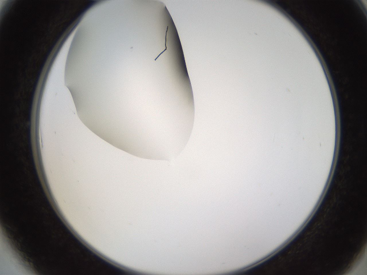 folderID593_plateID1593_batchID6726_wellNum6_profileID1_d2_r105599_ef.jpg