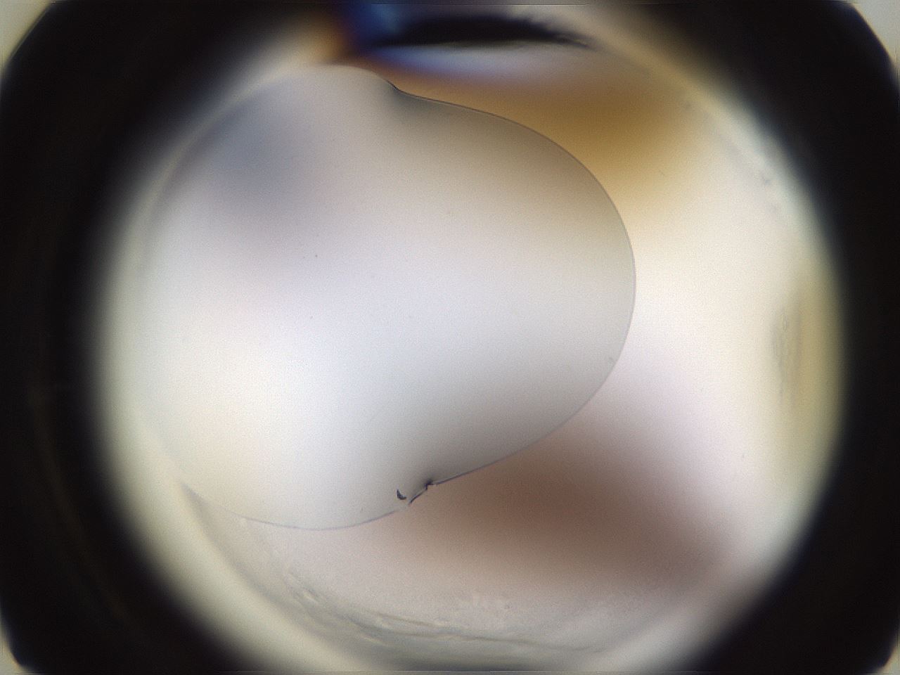 folderID595_plateID2595_batchID13189_wellNum6_profileID1_d3_r206235_ef.jpg