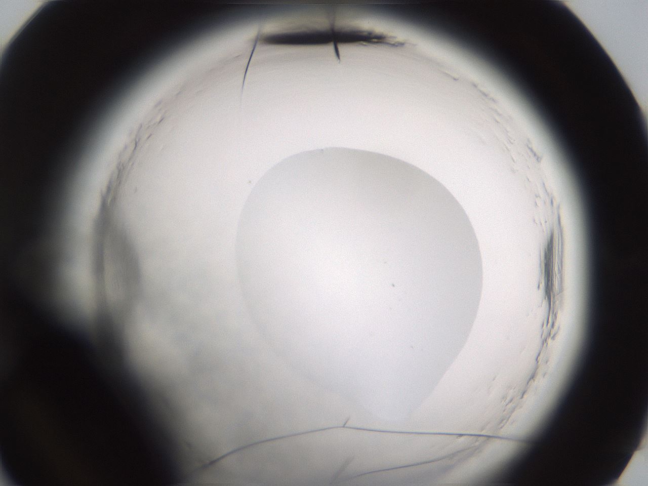 folderID595_plateID2595_batchID13189_wellNum96_profileID1_d3_r206505_ef.jpg