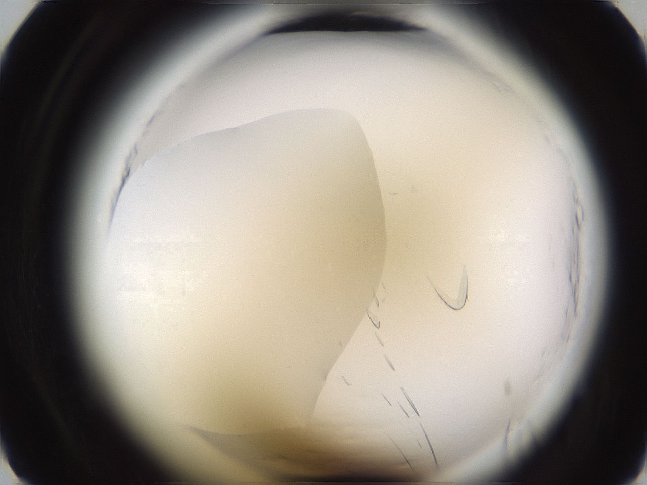 folderID596_plateID2596_batchID13191_wellNum6_profileID1_d1_r206809_ef.jpg