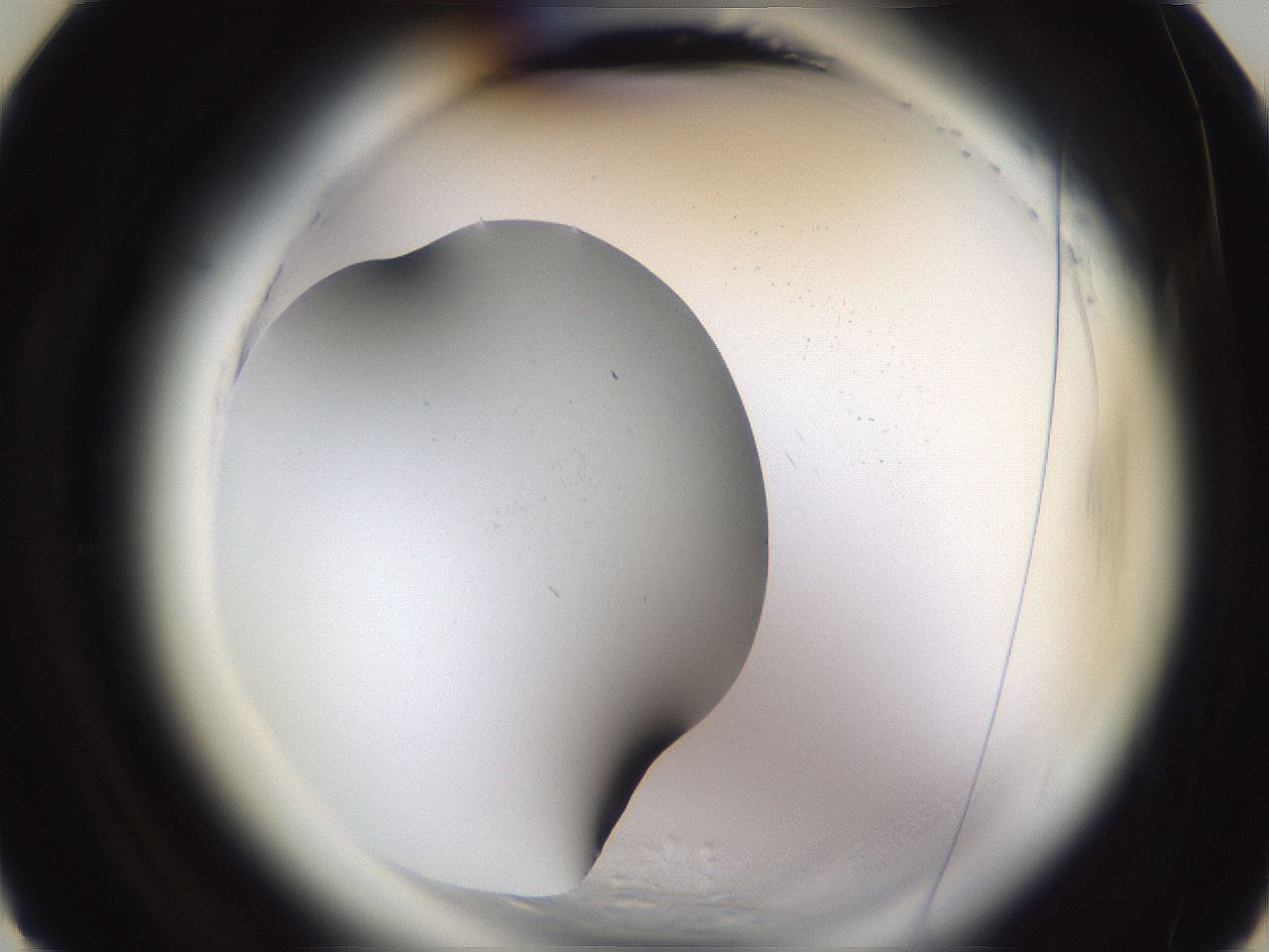 folderID596_plateID2596_batchID13191_wellNum6_profileID1_d3_r206811_ef.jpg
