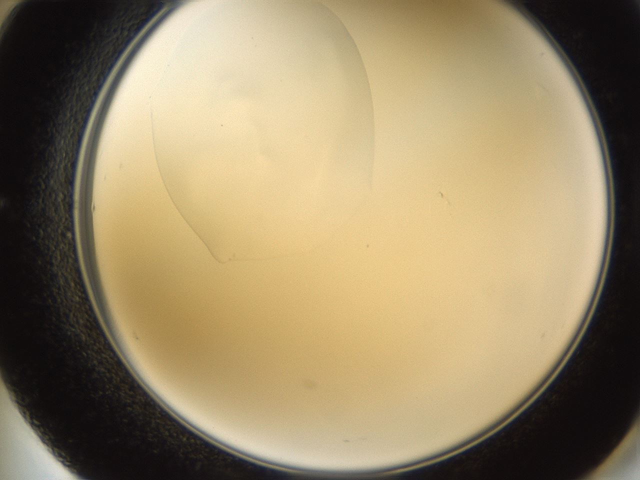 folderID597_plateID1597_batchID6720_wellNum60_profileID1_d2_r104555_ef.jpg