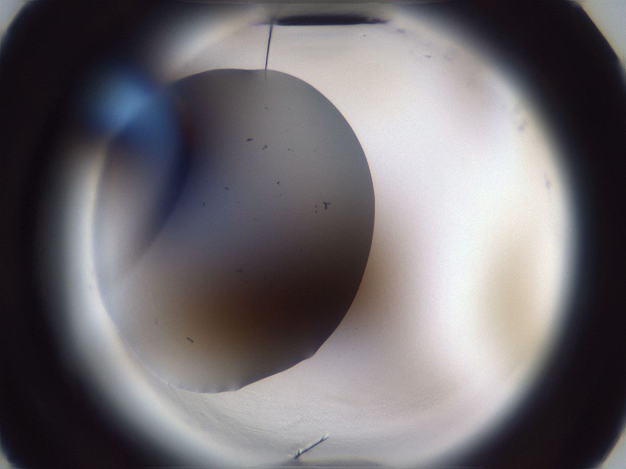 folderID598_plateID2598_batchID13155_wellNum2_profileID1_d3_r197294_ef.jpg