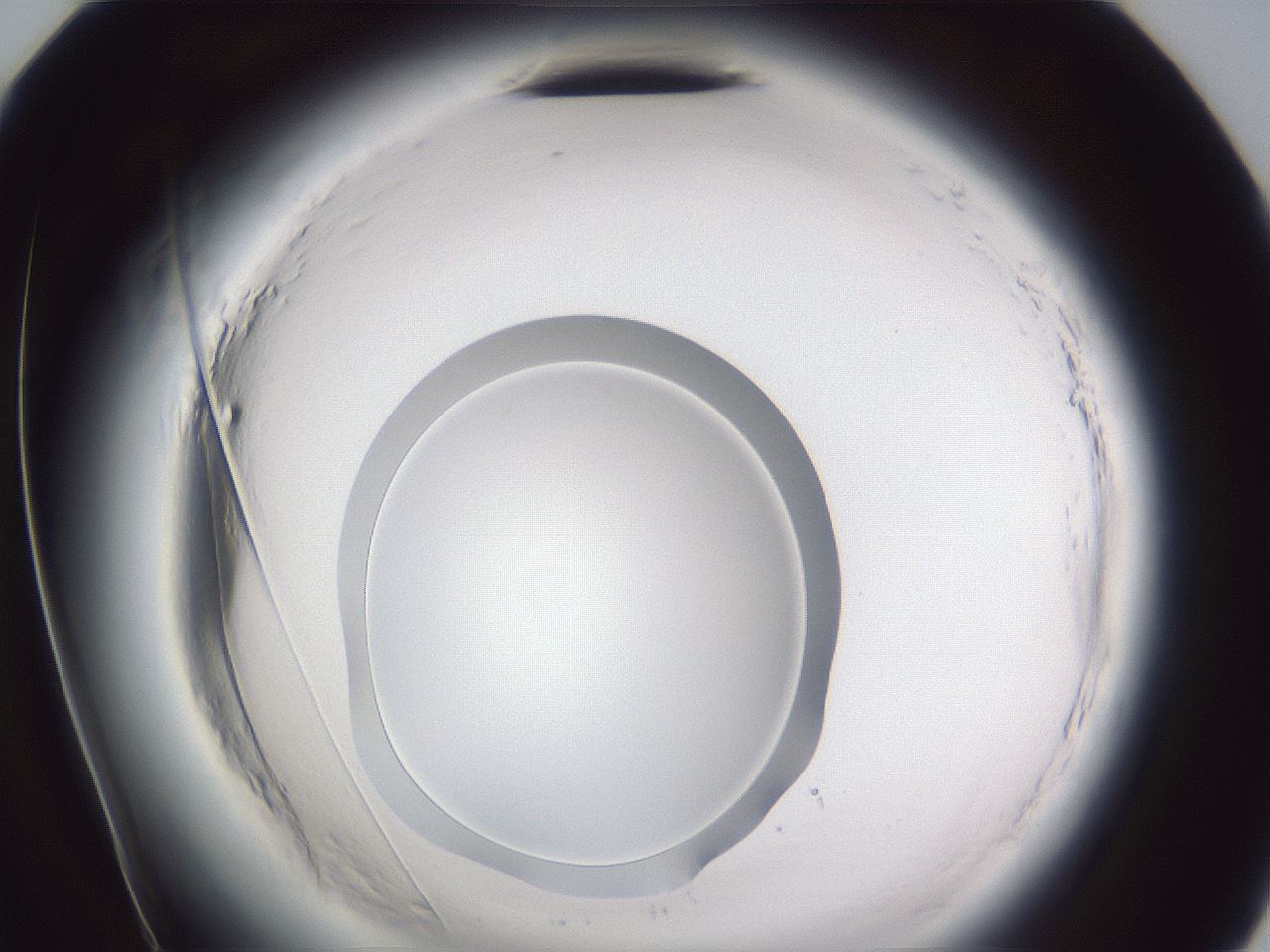 folderID598_plateID2598_batchID13155_wellNum72_profileID1_d2_r197503_ef.jpg