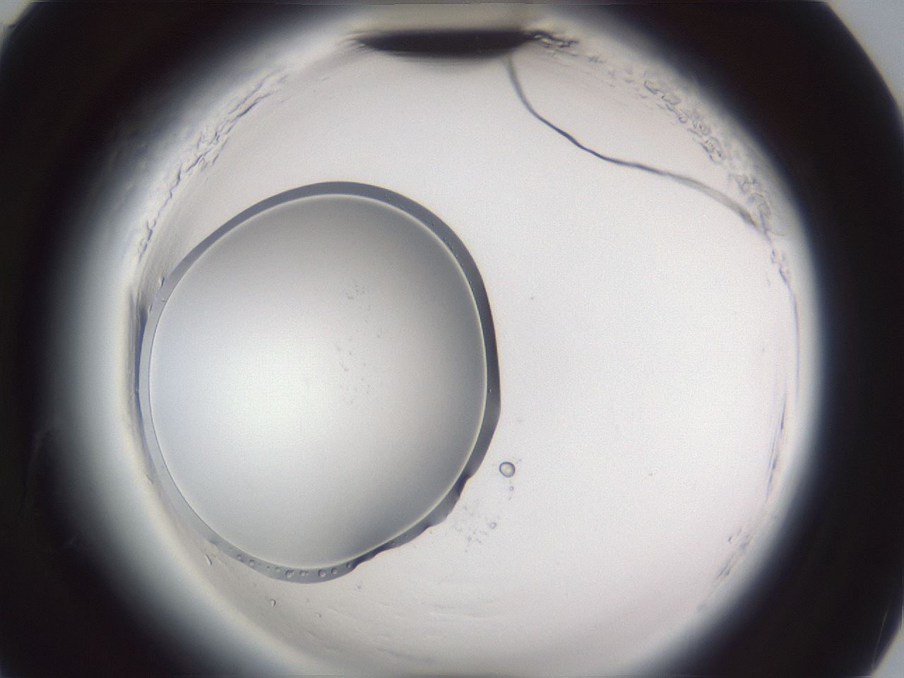 folderID598_plateID2598_batchID13155_wellNum90_profileID1_d2_r197557_ef.jpg
