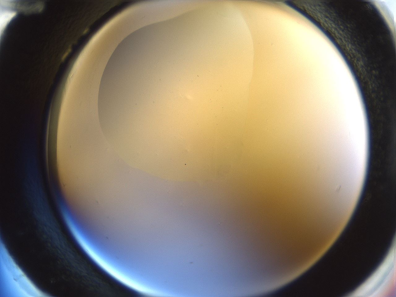 folderID599_plateID1599_batchID6728_wellNum96_profileID1_d2_r106163_ef.jpg