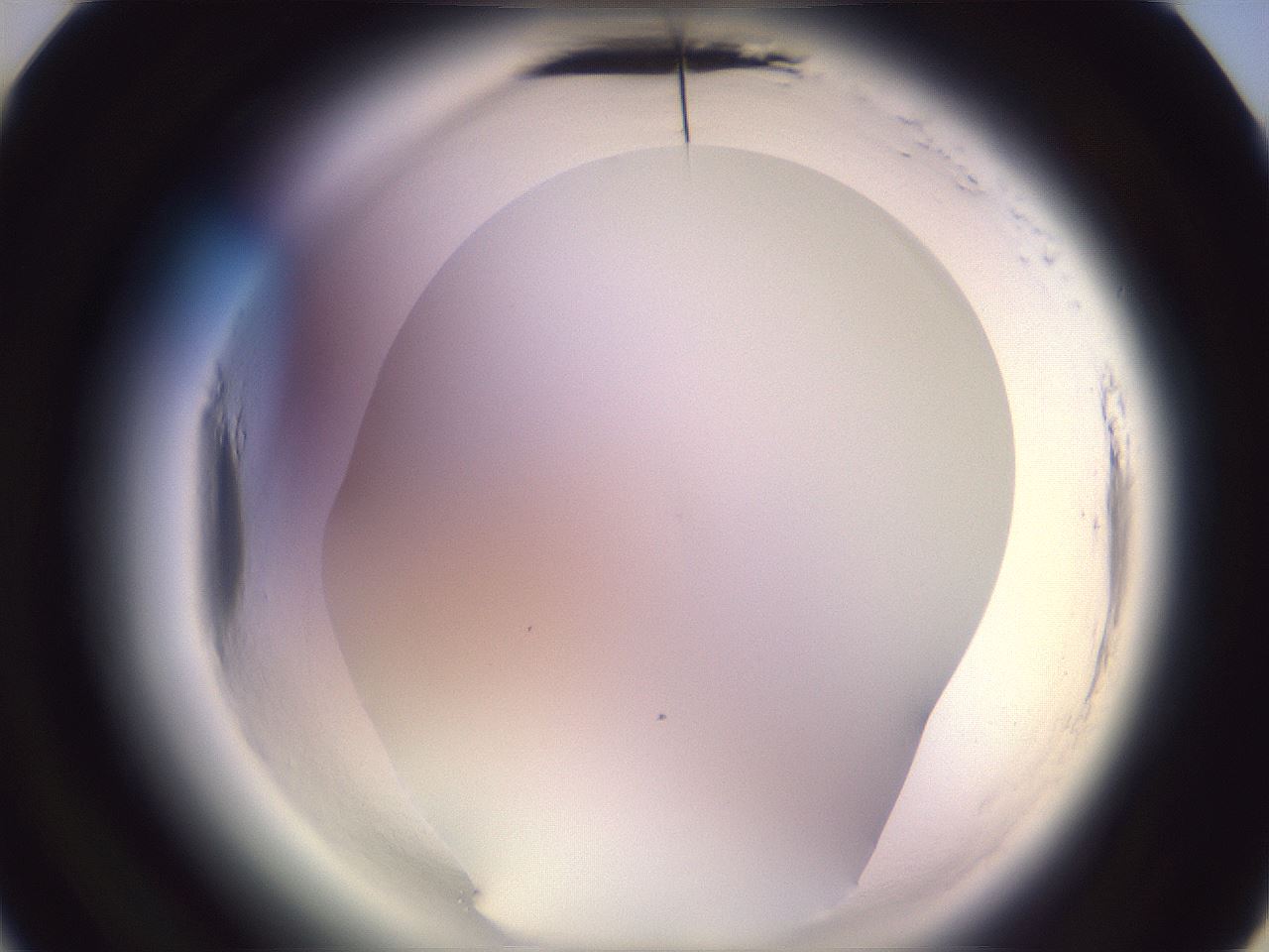 folderID599_plateID2599_batchID13157_wellNum22_profileID1_d3_r198218_ef.jpg