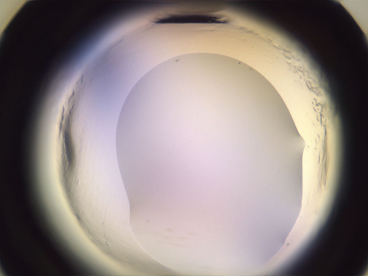 folderID600_plateID2600_batchID13161_wellNum23_profileID1_d3_r198797_ef.jpg