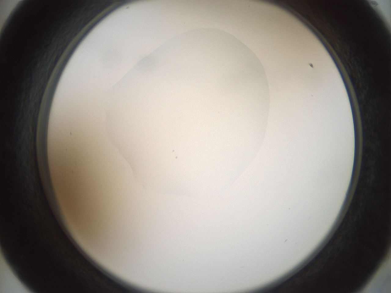 folderID600_plateID1600_batchID6725_wellNum57_profileID1_d2_r105509_ef.jpg