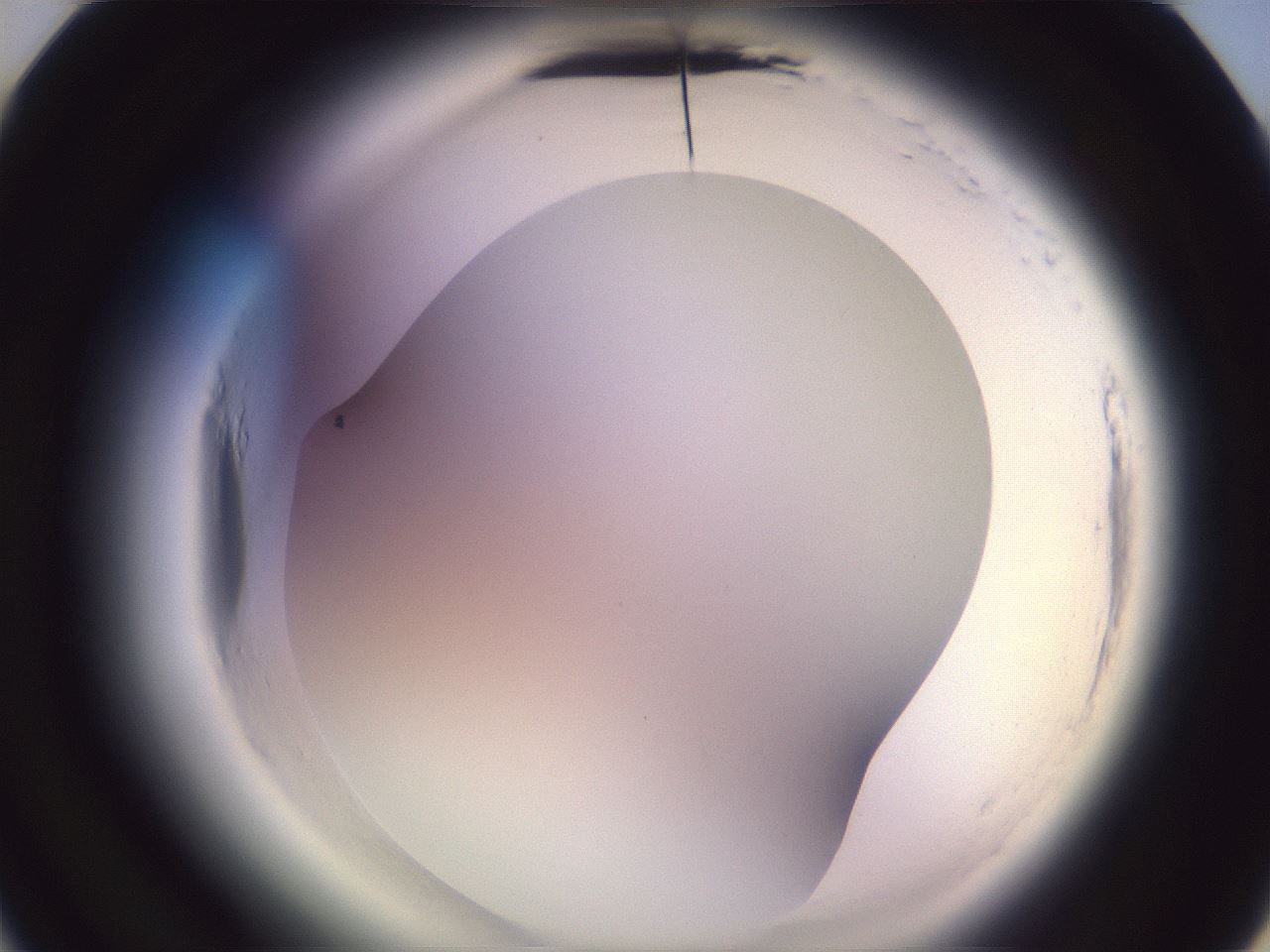 folderID600_plateID2600_batchID13161_wellNum22_profileID1_d3_r198794_ef.jpg