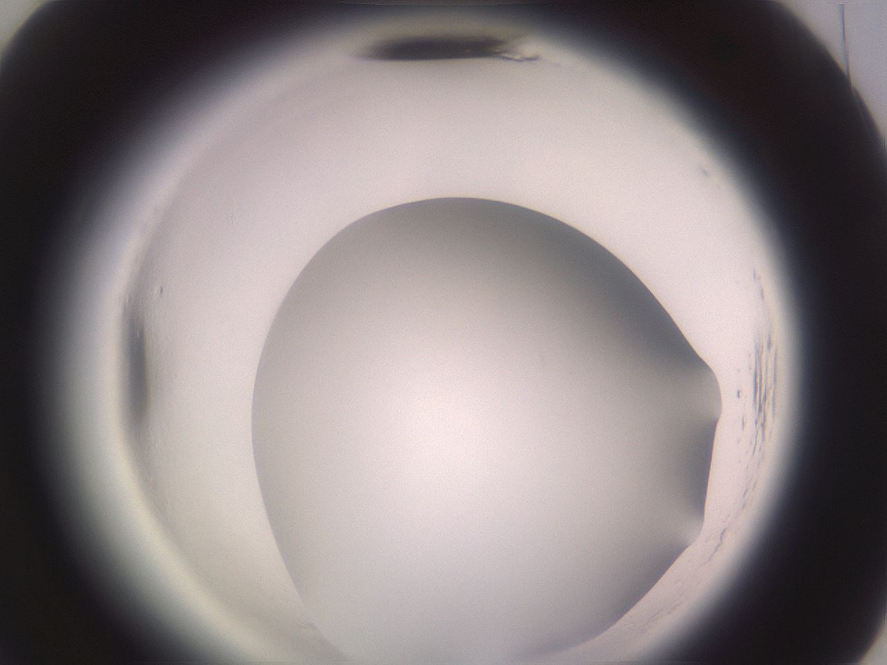 folderID600_plateID2600_batchID13161_wellNum70_profileID1_d3_r198938_ef.jpg