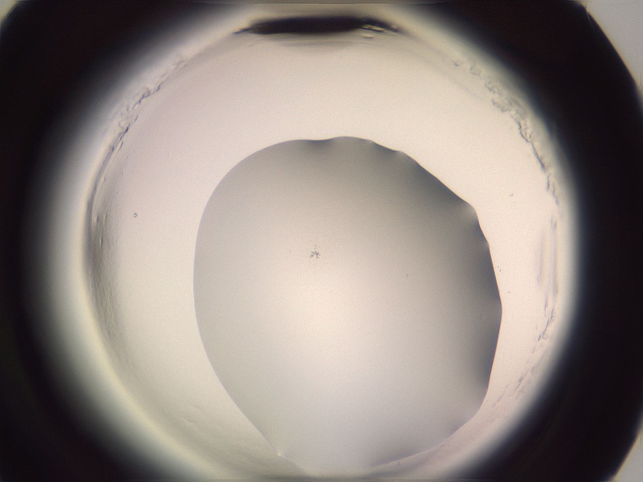 folderID600_plateID2600_batchID13161_wellNum78_profileID1_d3_r198962_ef.jpg