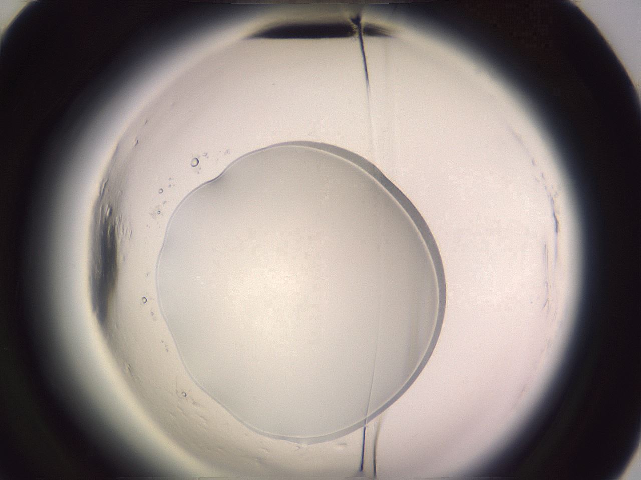 folderID600_plateID2600_batchID13161_wellNum80_profileID1_d2_r198967_ef.jpg