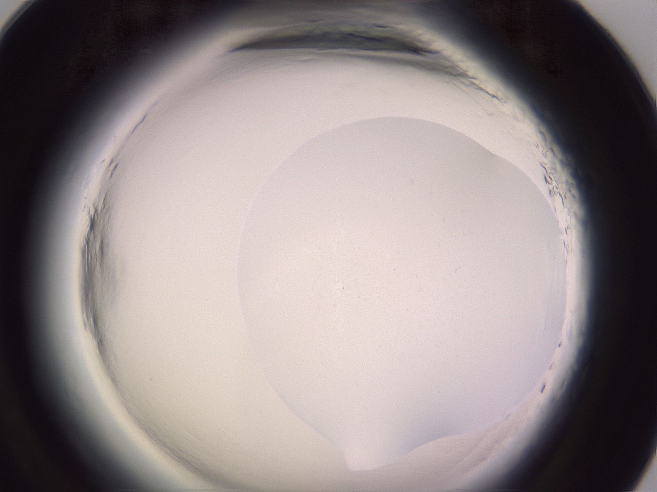 folderID600_plateID2600_batchID13161_wellNum93_profileID1_d1_r199005_ef.jpg