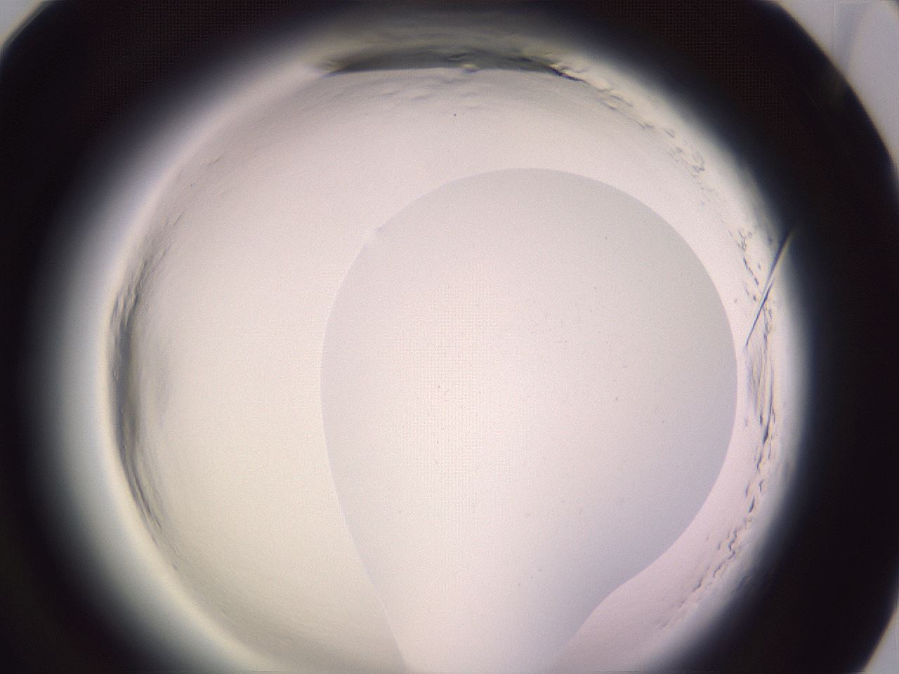 folderID600_plateID2600_batchID13161_wellNum94_profileID1_d1_r199008_ef.jpg