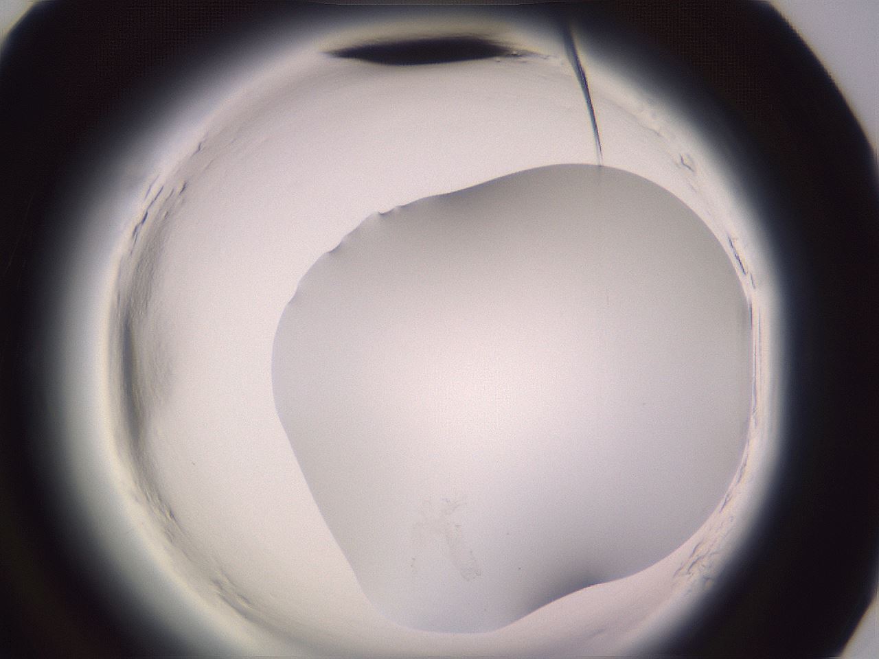 folderID600_plateID2600_batchID13161_wellNum94_profileID1_d3_r199010_ef.jpg