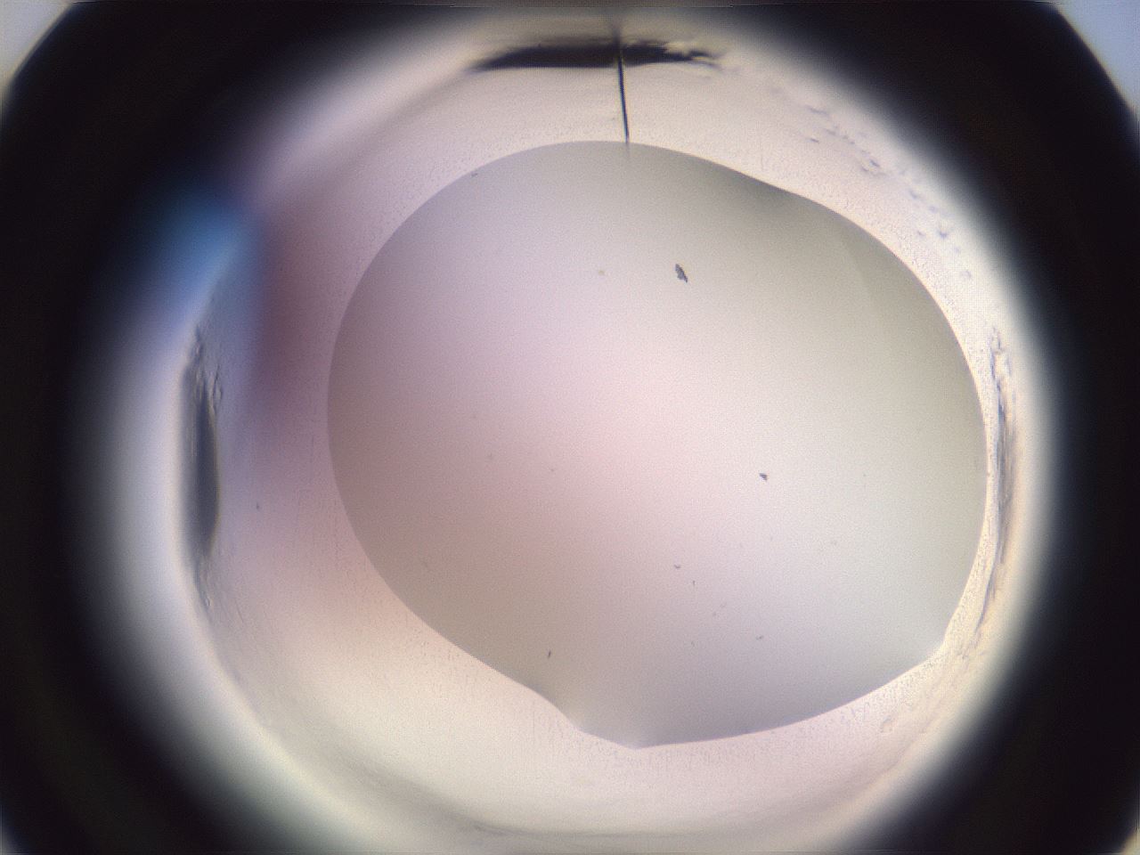 folderID601_plateID2601_batchID13164_wellNum22_profileID1_d3_r199658_ef.jpg