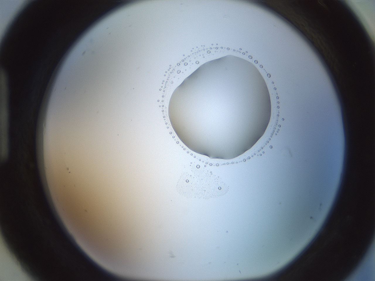 folderID602_plateID1602_batchID6722_wellNum92_profileID1_d1_r105002_ef.jpg