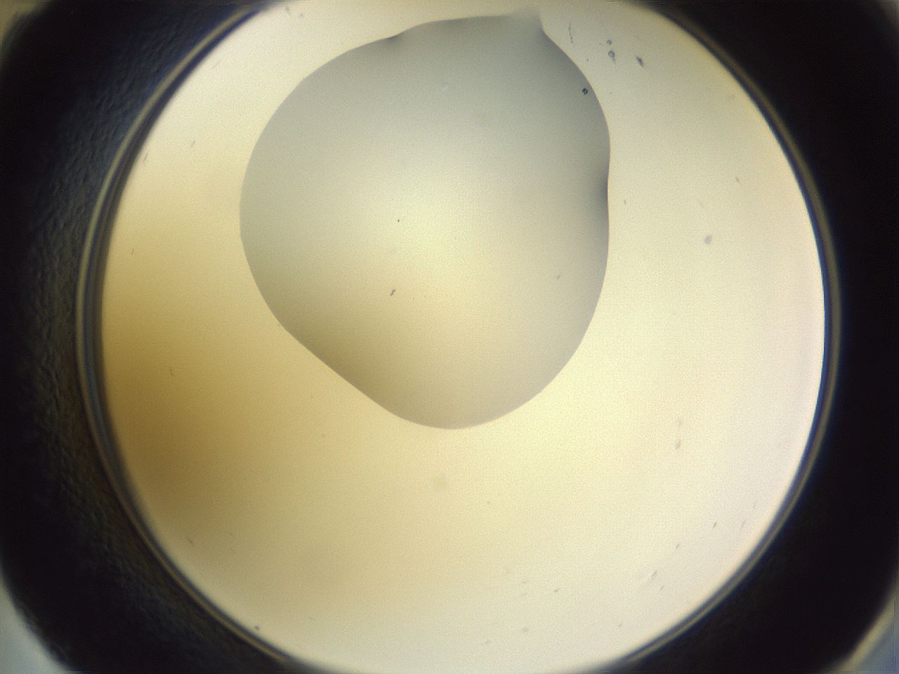folderID604_plateID1604_batchID6727_wellNum59_profileID1_d2_r105897_ef.jpg