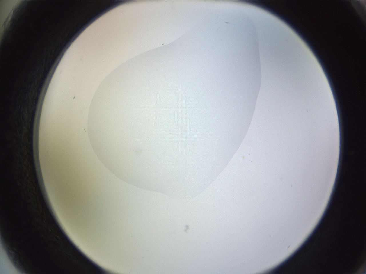 folderID604_plateID1604_batchID6727_wellNum75_profileID1_d2_r105929_ef.jpg