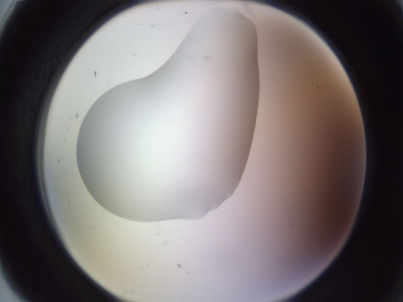 folderID604_plateID1604_batchID6727_wellNum91_profileID1_d2_r105961_ef.jpg