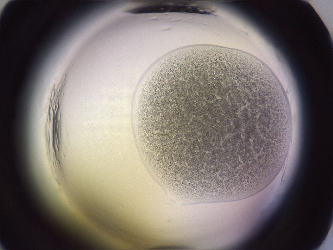 folderID606_plateID2606_batchID13176_wellNum4_profileID1_d1_r203635_ef.jpg