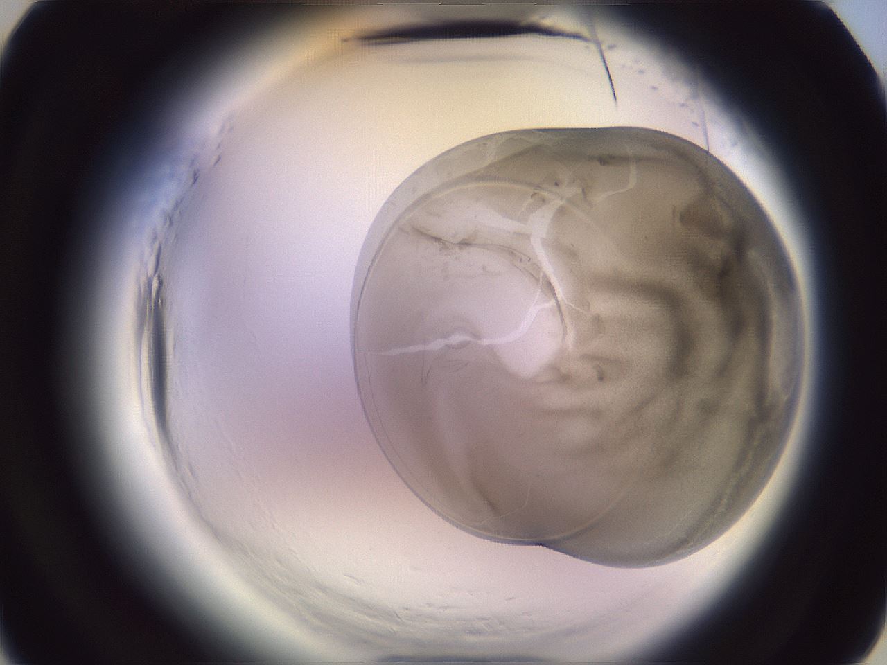 folderID606_plateID2606_batchID13176_wellNum4_profileID1_d3_r203637_ef.jpg