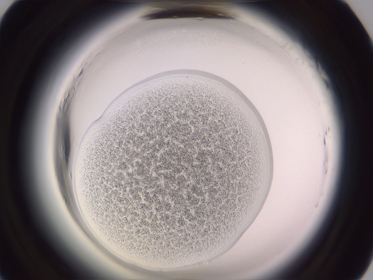 folderID607_plateID2607_batchID13180_wellNum20_profileID1_d1_r204547_ef.jpg