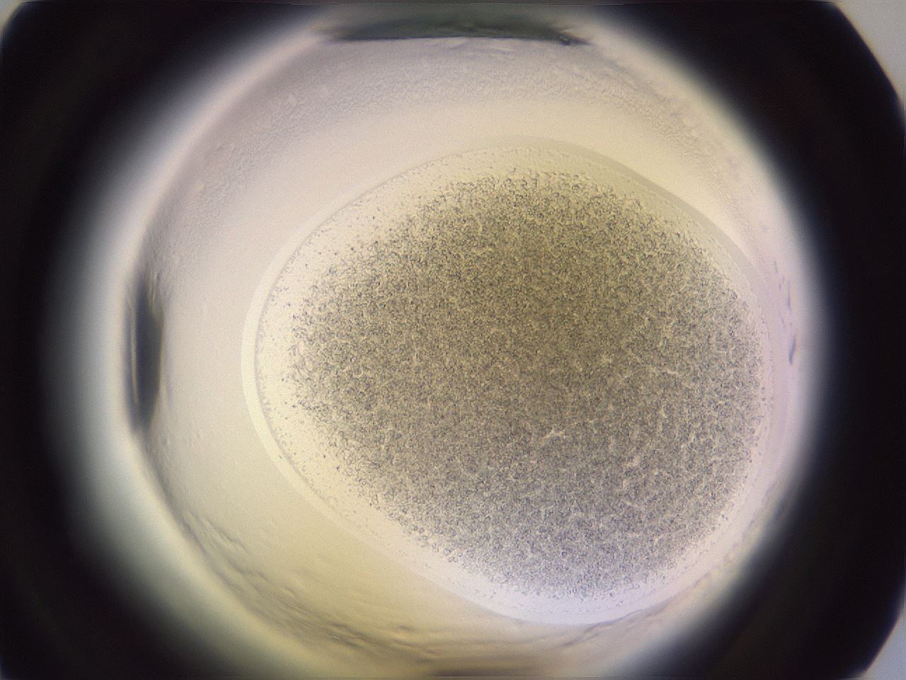 folderID608_plateID2608_batchID13184_wellNum15_profileID1_d1_r204820_ef.jpg