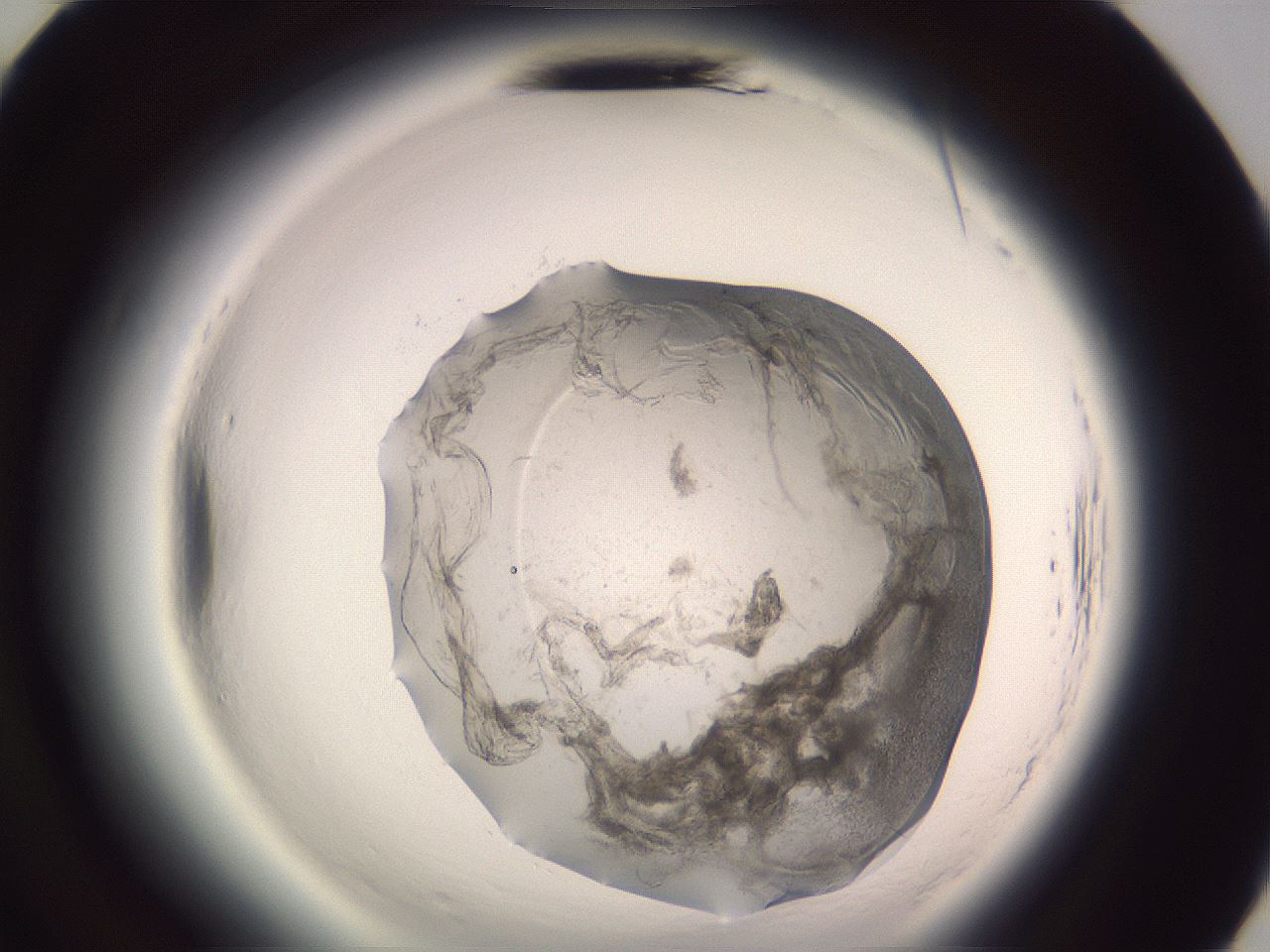 folderID608_plateID2608_batchID13184_wellNum70_profileID1_d3_r204987_ef.jpg