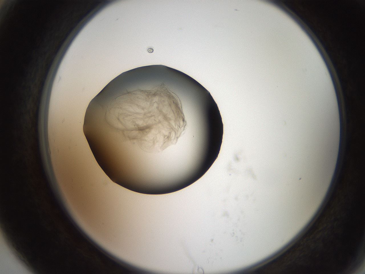 folderID617_plateID1617_batchID6744_wellNum79_profileID1_d2_r107541_ef.jpg