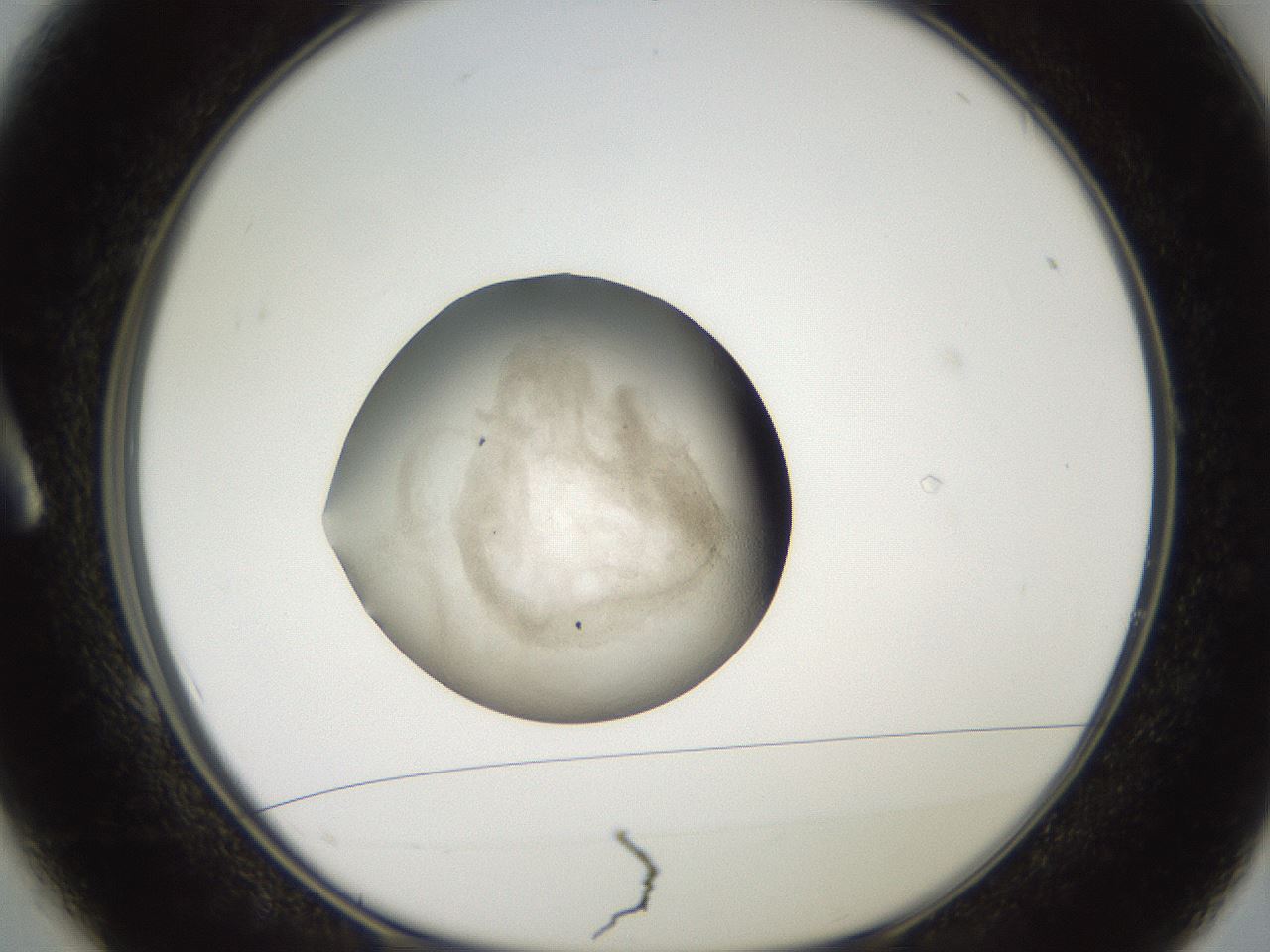 folderID618_plateID1618_batchID6746_wellNum1_profileID1_d1_r107576_ef.jpg