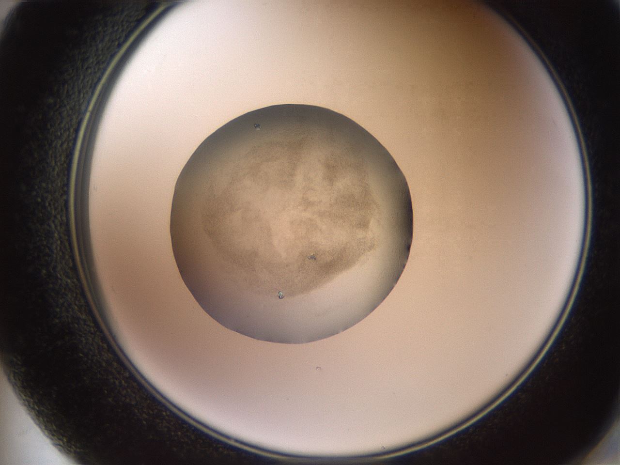 folderID619_plateID1619_batchID6747_wellNum72_profileID1_d2_r107911_ef.jpg