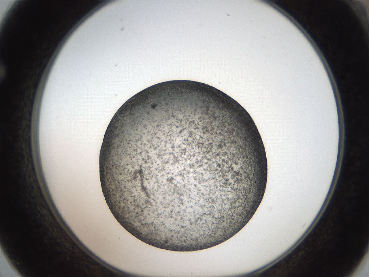 folderID61_plateID2061_batchID9137_wellNum62_profileID1_d1_r139252_ef.jpg