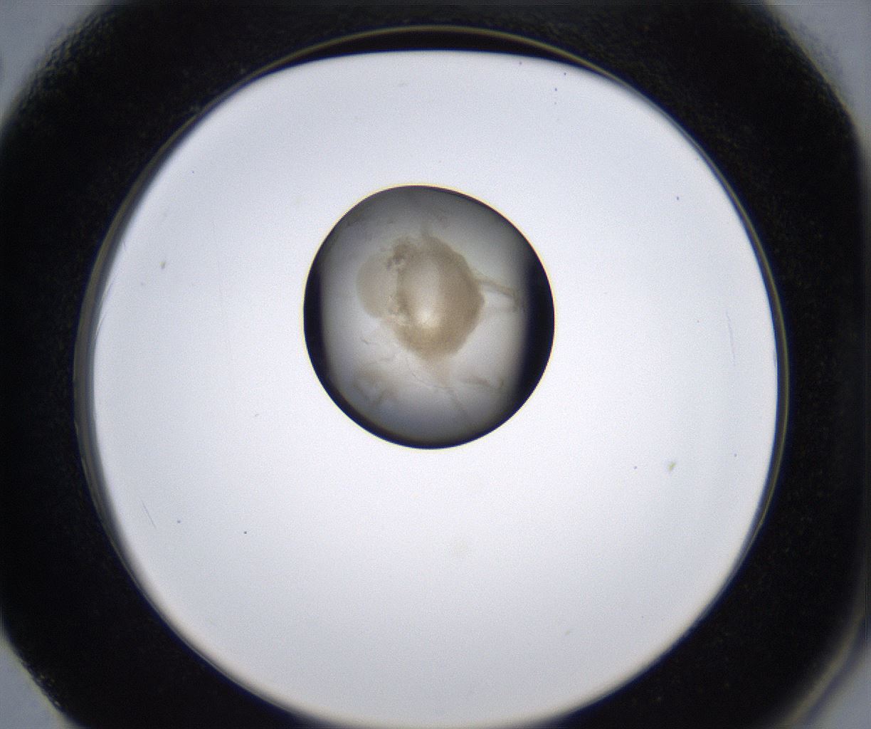 folderID211_plateID2211_batchID10045_wellNum62_profileID1_d2_r150450_ef.jpg
