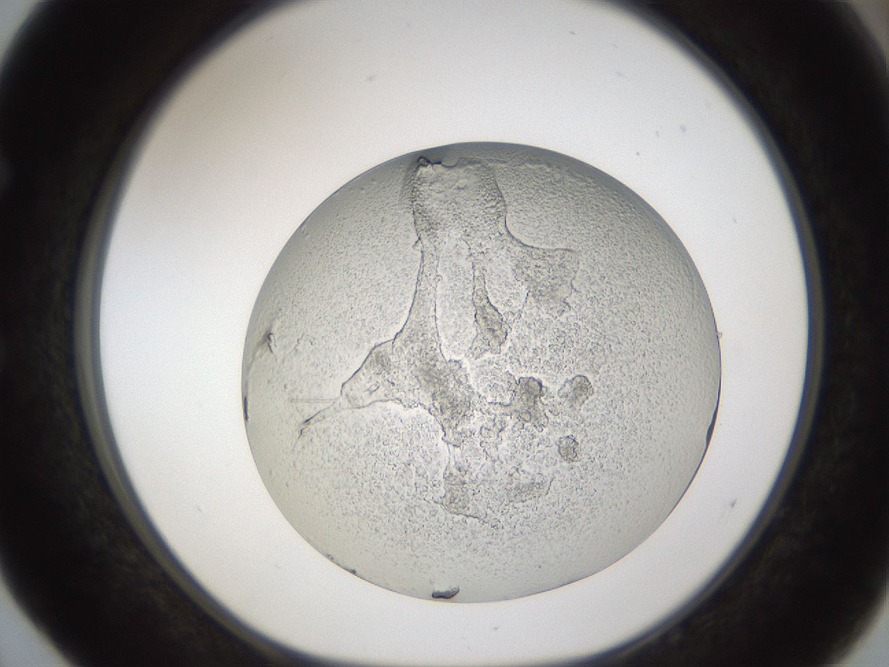 folderID213_plateID1213_batchID3692_wellNum52_profileID1_d1_r69062_ef.jpg