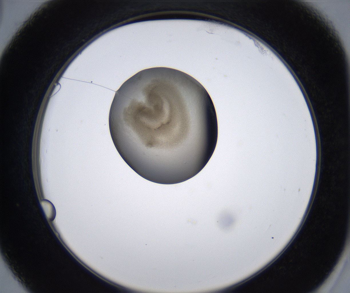 folderID213_plateID2213_batchID10048_wellNum39_profileID1_d2_r150596_ef.jpg