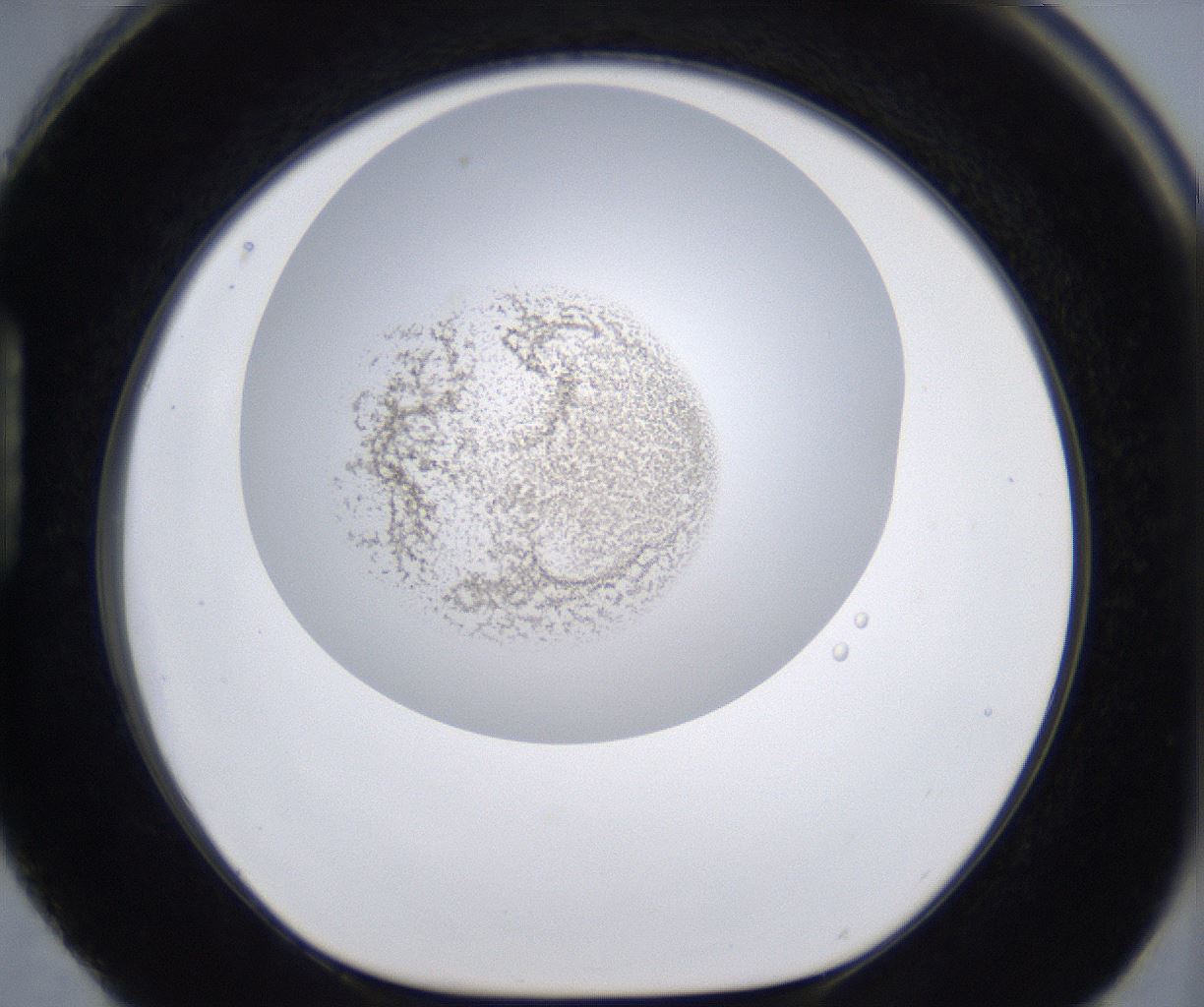 folderID213_plateID2213_batchID10048_wellNum88_profileID1_d1_r150693_ef.jpg