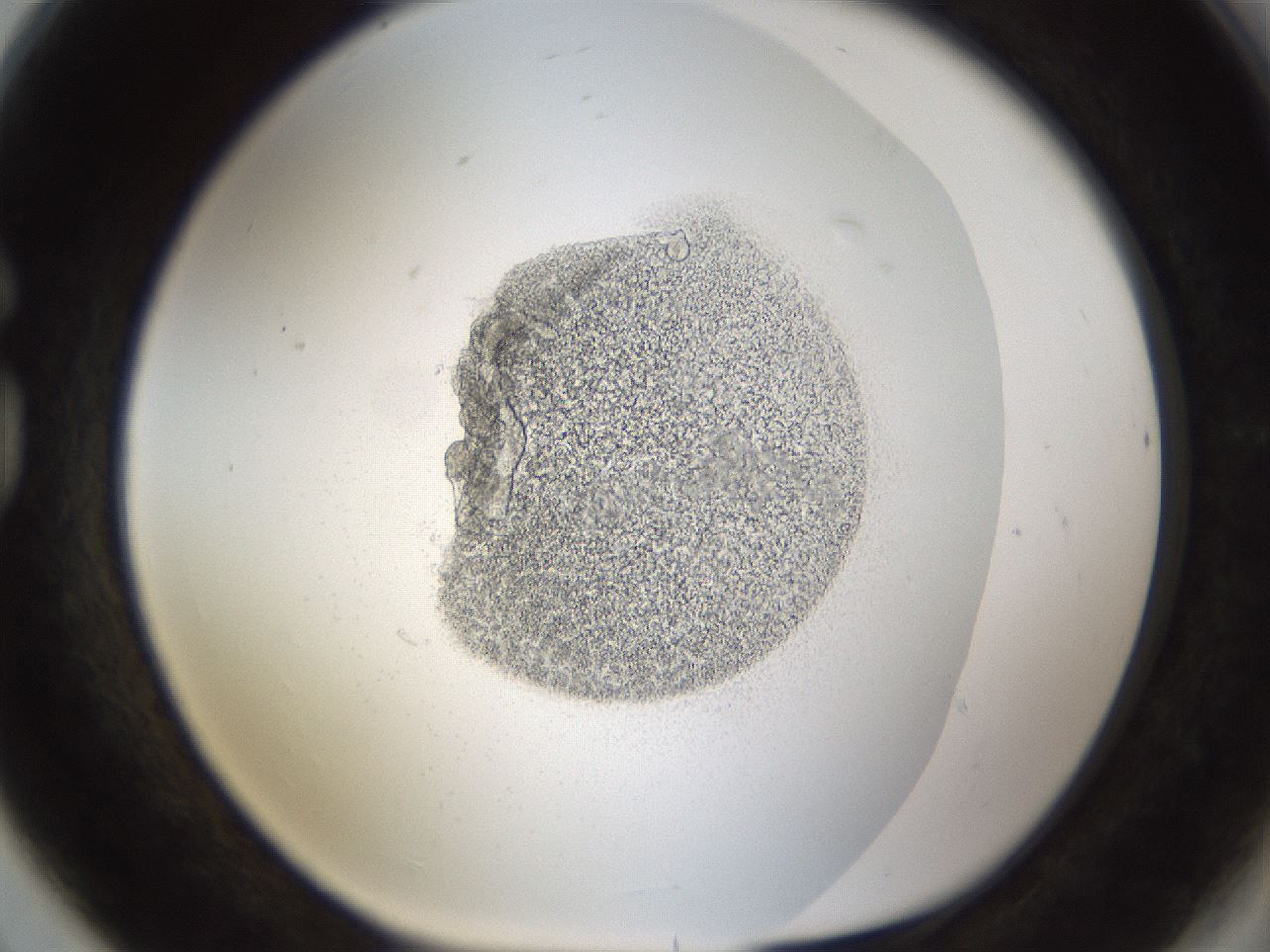 folderID214_plateID1214_batchID3712_wellNum80_profileID1_d1_r69694_ef.jpg