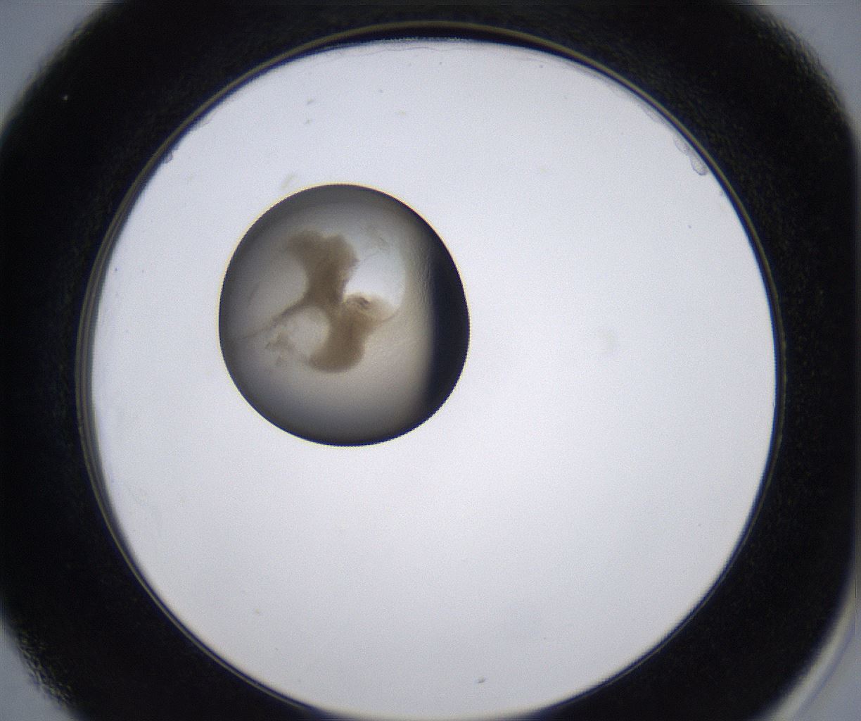 folderID215_plateID2215_batchID10049_wellNum25_profileID1_d2_r150760_ef.jpg