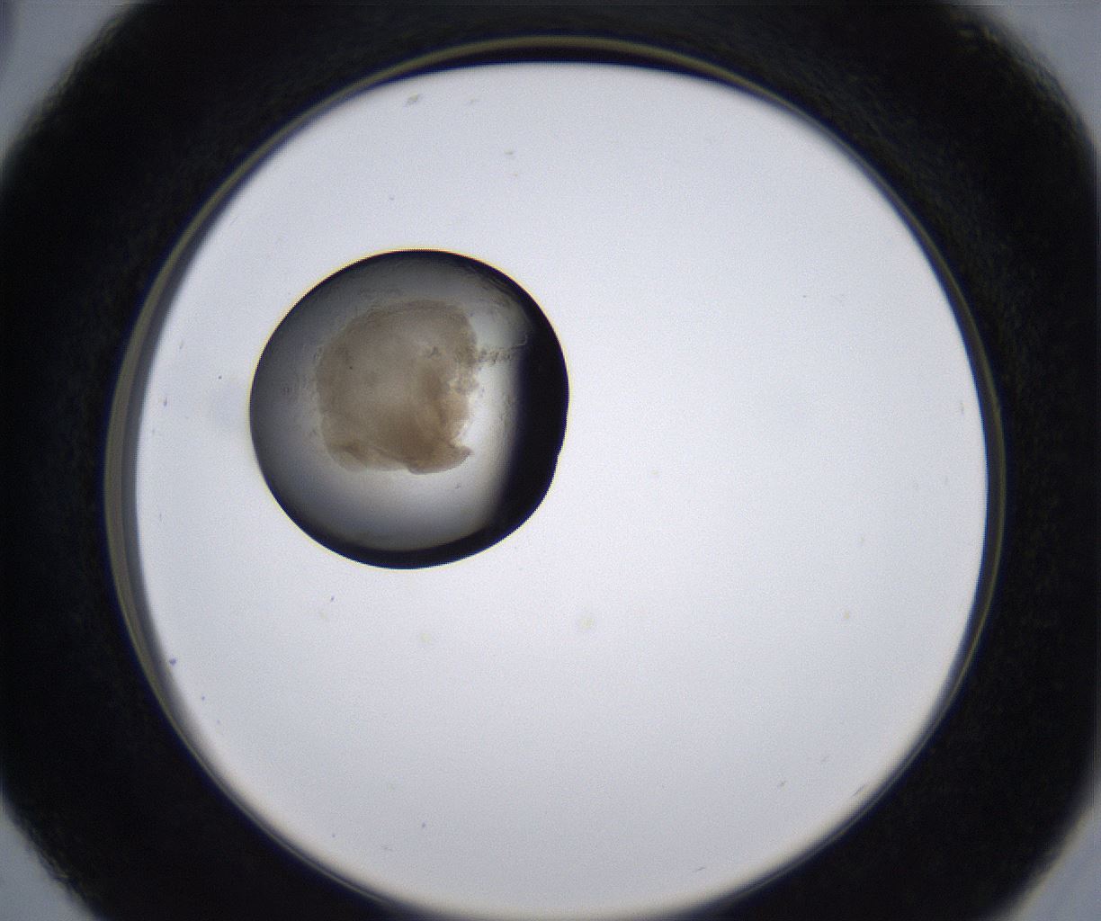 folderID215_plateID2215_batchID10049_wellNum29_profileID1_d2_r150768_ef.jpg