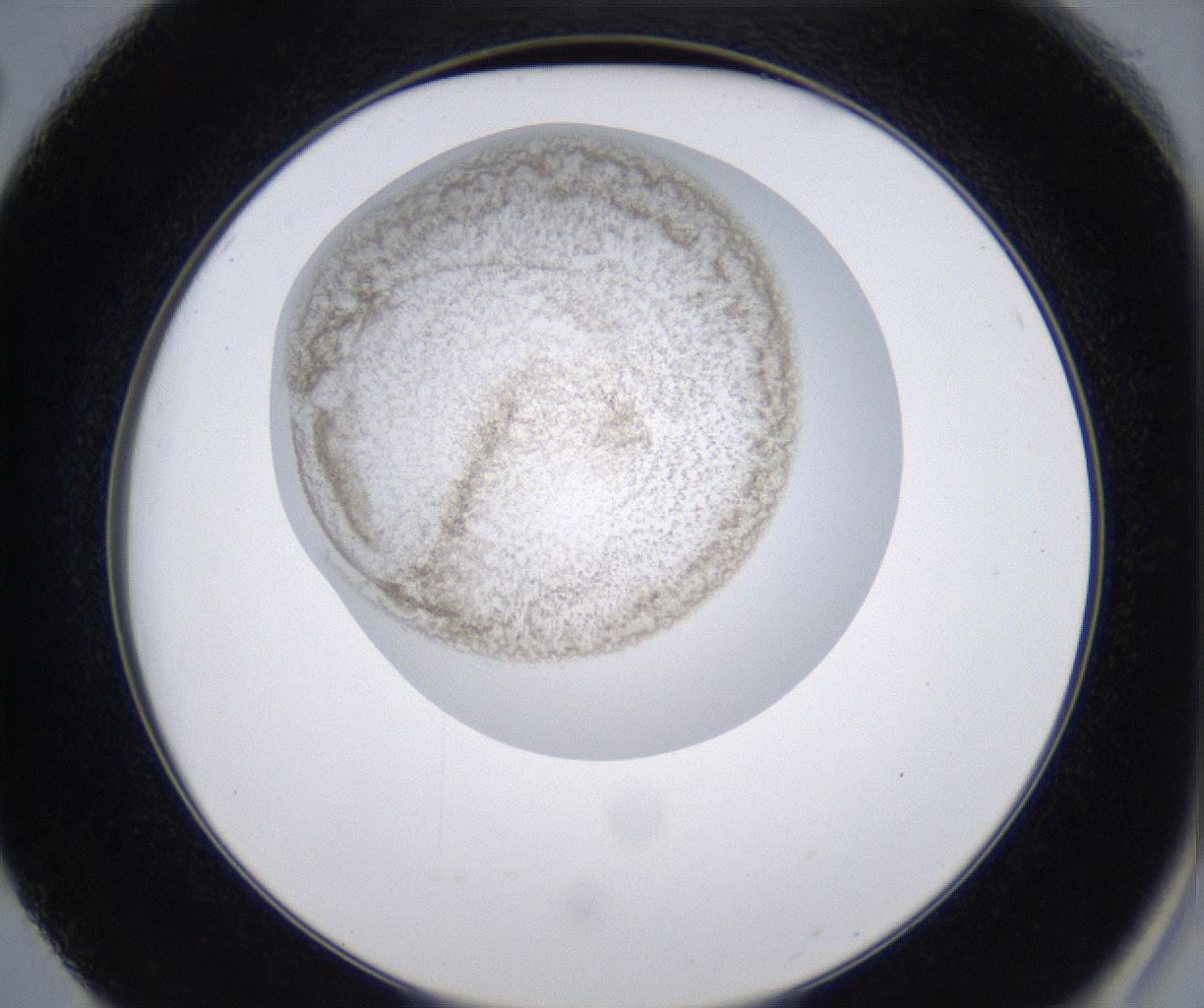 folderID215_plateID2215_batchID10049_wellNum50_profileID1_d2_r150810_ef.jpg