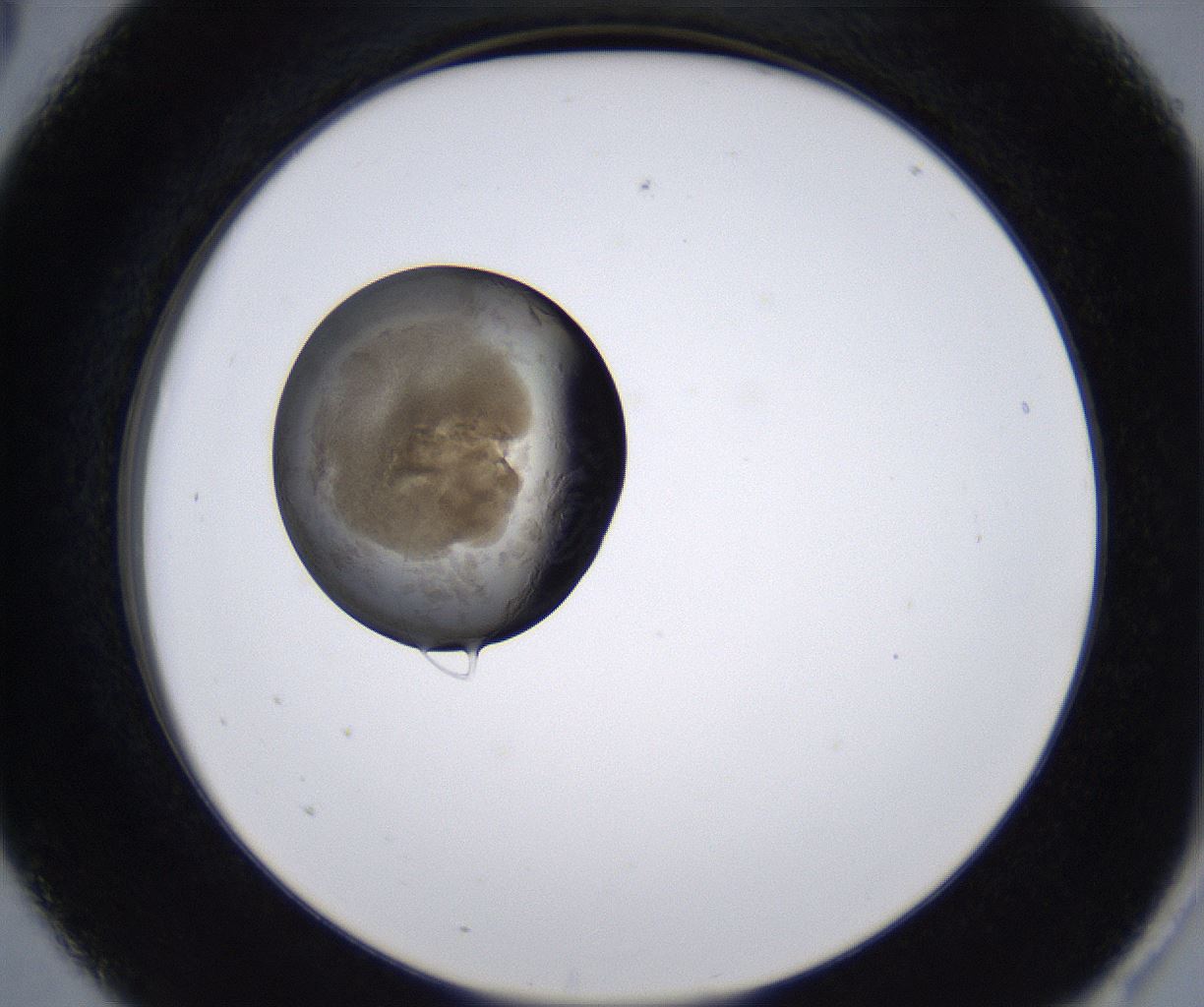folderID215_plateID2215_batchID10049_wellNum5_profileID1_d2_r150720_ef.jpg