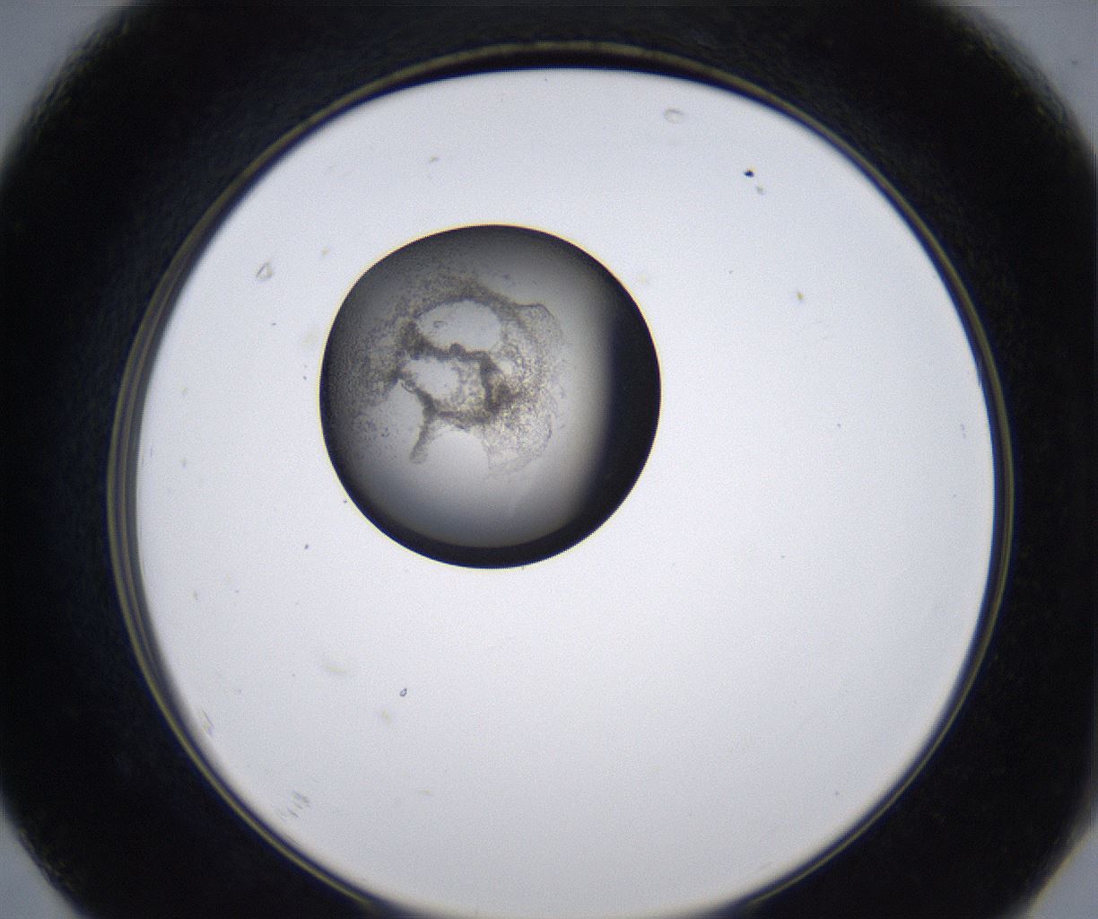 folderID215_plateID2215_batchID10049_wellNum67_profileID1_d2_r150844_ef.jpg